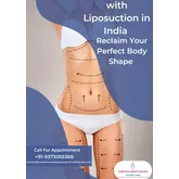 Liposuction surgery India