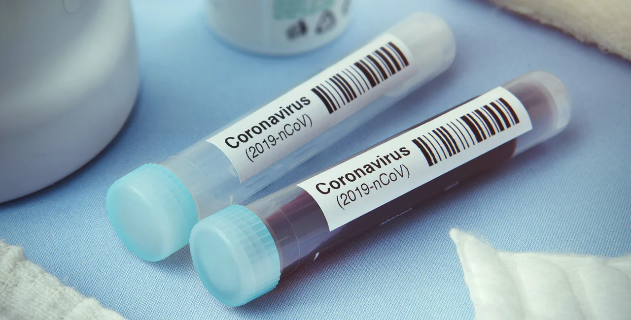 Detail of coronavirus test tubes via iStock / narvikk