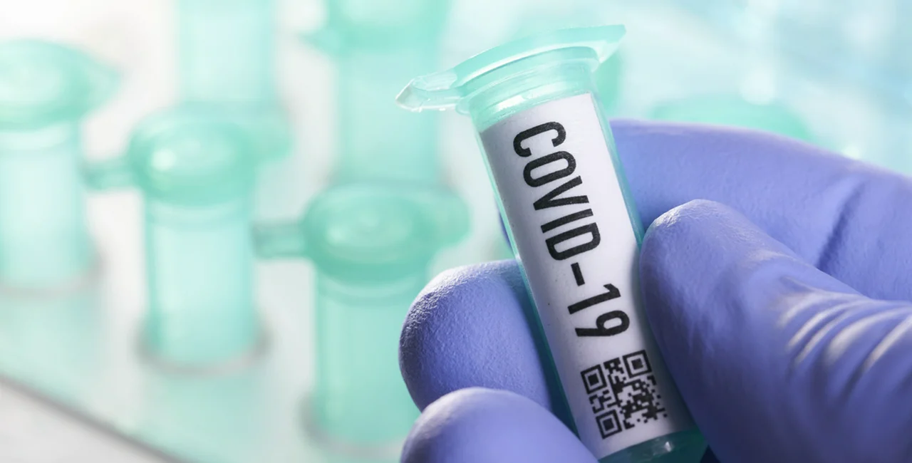 Daily rise in Czech COVID-19 cases under 100 cases for third straight day, 6,141 total