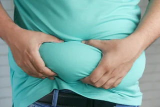 The Czech Republic has the third highest obesity rate in Europe