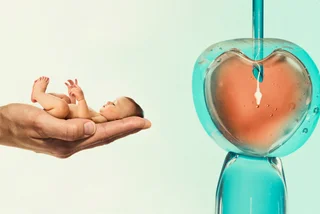 Czechia still bars single women from IVF: Here's who qualifies and what may finally change