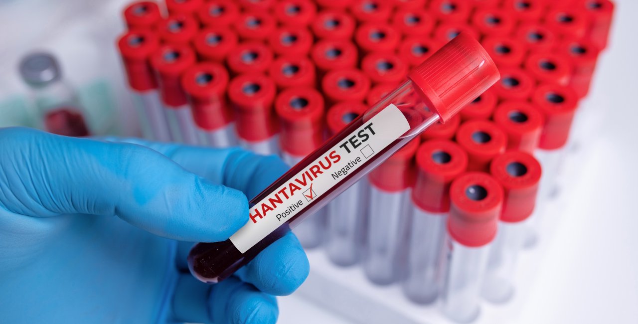 Hantavirus in Czechia: The strains, the risks, and what you need to know