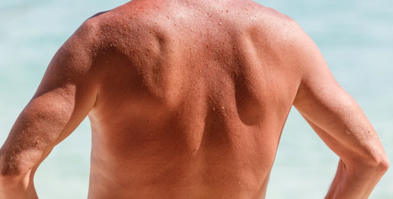 Nudity in Czechia: The unwritten rules of saunas, beaches, and pools